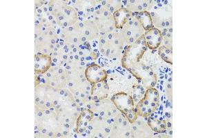 Immunohistochemistry of paraffin-embedded mouse kidney using MTERFD3 antibody (ABIN5974877) at dilution of 1/100 (40x lens). (MTERFD3 Antikörper)