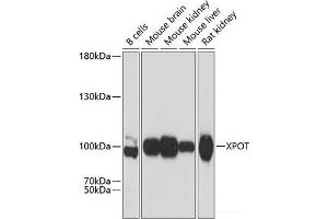 Western blot analysis of extracts of various cell lines using XPOT Polyclonal Antibody at dilution of 1:3000. (XPOT Antikörper)