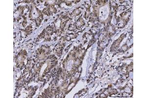 IHC analysis of MLH1 using anti-MLH1 antibody (ABIN7599691). (MLH1 Antikörper  (AA 108-756))