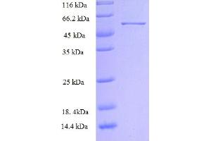 SDS-PAGE (SDS) image for rho Guanine Nucleotide Exchange Factor (GEF) 7 (ARHGEF7) (AA 1-250), (partial) protein (GST tag) (ABIN5712151) (ARHGEF7 Protein (AA 1-250, partial) (GST tag))