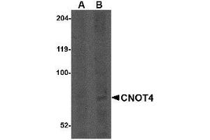 Western blot analysis of CNOT4 in A549 lysate with AP30240PU-N CNOT4 antibody at (A) 1 and (B) 2 μg/ml. (CNOT4 Antikörper  (N-Term))