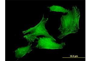 Immunofluorescence of purified MaxPab antibody to PDLIM7 on HeLa cell. (PDLIM7 Antikörper  (AA 1-457))