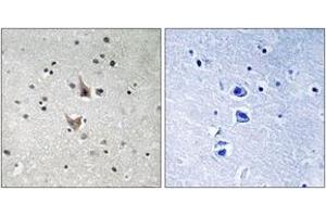 Immunohistochemistry analysis of paraffin-embedded human brain, using PSEN1 (Phospho-Ser357) Antibody. (Presenilin 1 Antikörper  (pSer357))