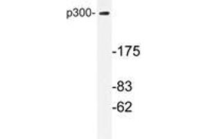 Western blot analysis with EP300 / P300 antibody in extracts from MDA-MB-435 cells. (p300 Antikörper)