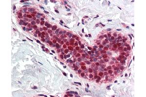 Anti-PCNA antibody IHC of human breast. (PCNA Antikörper  (Internal Region))