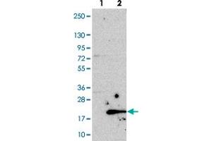 Western blot analysis of Lane 1: Negative control (vector only transfected HEK293T lysate). (C19orf48 Antikörper)