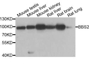 Western blot analysis of extracts of various cell lines, using BBS2 antibody (ABIN5975143) at 1/1000 dilution. (BBS2 Antikörper)