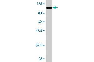 Western Blot detection against Immunogen (106. (VCAM1 Antikörper  (AA 1-739))