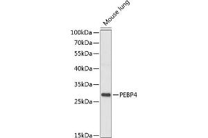 Western blot analysis of extracts of mouse lung, using PEBP4 antibody (ABIN7269279) at 1:1000 dilution. (PEBP4 Antikörper  (AA 23-120))