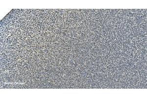 IHC analysis of LSM8 using anti-LSM8 antibody (ABIN7599579). (NAA38 Antikörper  (AA 1-96))