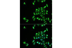 Immunofluorescence analysis of HeLa cells using CSNK1A1L antibody (ABIN5973884). (CSNK1A1L Antikörper)