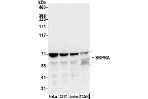 anti-Signal Recognition Particle Receptor Subunit alpha (SRPRA) (AA 225-275) antibody