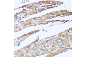 Immunohistochemistry of paraffin-embedded rat heart using CASP3 antibody (ABIN4903140) at dilution of 1:100 (40x lens).