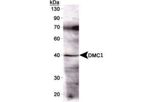 Western blot detection of DMC1 (37 kDa) from mouse testis using DMC1 monoclonal antibody, clone 1D12/4  (1 : 1000). (DMC1 Antikörper)