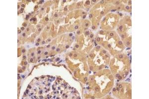 Immunohistochemistry (IHC) image for anti-Argininosuccinate Synthase 1 (ASS1) (AA 192-221) antibody (ABIN3030022)
