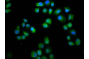 Immunofluorescence staining of Hela cells with ABIN7158363 at 1:66, counter-stained with DAPI. (LMO7 Antikörper  (AA 1301-1465))
