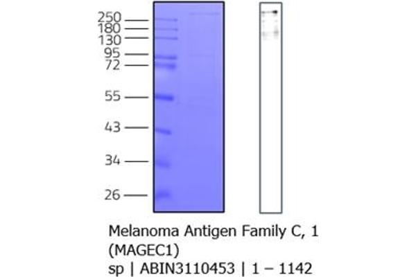 MAGEC1 Protein (AA 1-1142) (MBP tag,His tag)