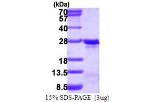 Transgelin 3 (TAGLN3) (AA 1-199) protein (His tag)