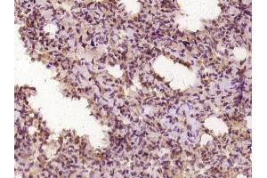Immunohistochemistry (Paraffin-embedded Sections) (IHC (p)) image for anti-Polymerase (DNA Directed), delta 1, Catalytic Subunit 125kDa (POLD1) (AA 101-200) antibody (ABIN1714356)