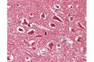 Immunohistochemistry (IHC) image for anti-Microtubule-Associated Protein, RP/EB Family, Member 2 (MAPRE2) (AA 300-350) antibody (ABIN2587188)