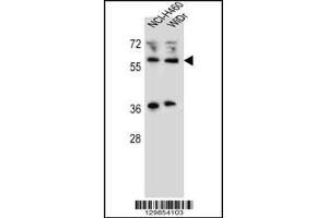 Western blot analysis in NCI-H460,WiDr cell line lysates (35ug/lane). (WTIP Antikörper  (AA 243-271))