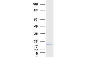 Western Blotting (WB) image for Synuclein, beta (SNCB) (Transcript Variant 2) protein (Myc-DYKDDDDK Tag) (ABIN2715250)