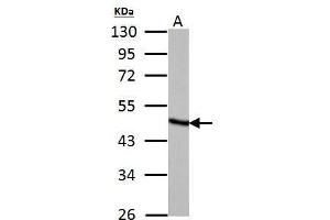 WB Image Fumarate hydratase antibody detects Fumarate hydratase protein by Western blot analysis.