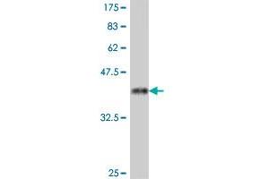 Western Blot detection against Immunogen (38. (PSMA Antikörper  (AA 547-656))