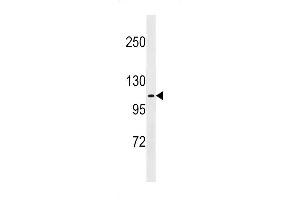 Western blot analysis in A375 cell line lysates (35ug/lane). (FARP1 Antikörper  (N-Term))