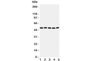 Western blot testing of ALDH3a1 antibody; Lane 1: SMMC-7721;  2: HeLa;  3: COLO320;  4: MCF-7;  5: A549 cell lysate