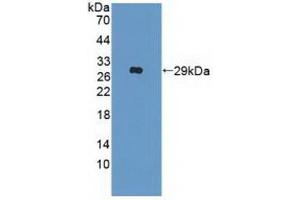 Detection of Recombinant IFNa/bR2, Human using Polyclonal Antibody to Interferon Alpha/Beta Receptor 2 (IFNa/bR2) (IFNAR2 Antikörper  (AA 27-243))