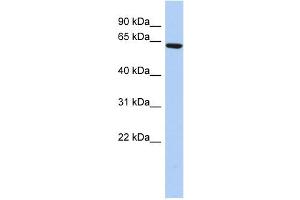 WB Suggested Anti-CCDC96 Antibody Titration: 0. (CCDC96 Antikörper  (N-Term))