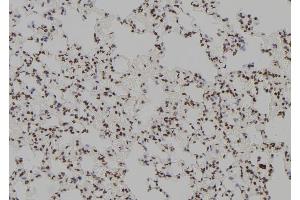 ABIN6279377 at 1/100 staining Rat lung tissue by IHC-P.