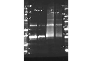 Goat anti Uricase antibody was used to detect purified Uricase under reducing and non-reducing conditions. (Urate Oxidase Antikörper)