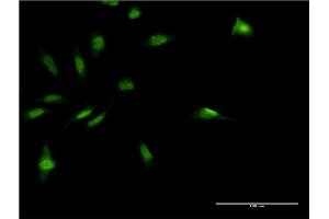 Immunofluorescence of monoclonal antibody to MDFI on HeLa cell. (MDFI Antikörper  (AA 33-110))
