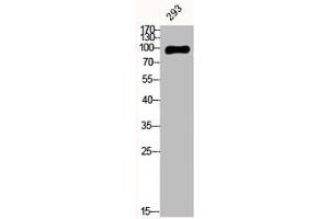 Western Blot analysis of 293 cells using E-cadherin Polyclonal Antibody (CDH1,CDH2,CDH3,CDH4 (C-Term) Antikörper)