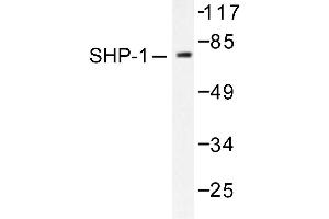 Image no. 1 for anti-Protein-tyrosine Phosphatase 1C (PTPN6) antibody (ABIN271911) (SHP1 Antikörper)