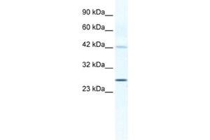 Western Blotting (WB) image for anti-Gap Junction Protein, beta 4, 30.3kDa (GJB4) antibody (ABIN2461387)