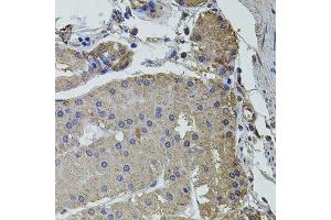 Immunohistochemistry of paraffin-embedded human stomach using UBE2S antibody. (UBE2S Antikörper  (AA 122-221))