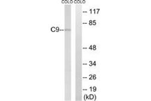 Western blot analysis of extracts from COLO cells, using C9 Antibody.
