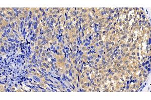 Immunohistochemistry (IHC) image for anti-BCL2-Like 2 (BCL2L2) (AA 2-193) antibody (ABIN7438820)