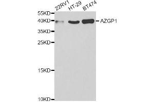 Western blot analysis of extracts of various cell lines, using AZGP1 antibody. (AZGP1 Antikörper)