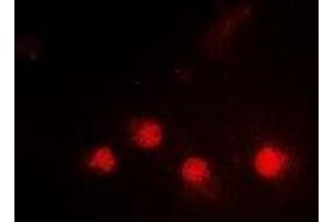 Immunofluorescent analysis of SMARCAD1 staining in HepG2 cells.