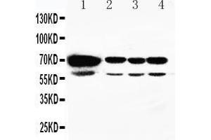 Anti-HSPA2 antibody, Western blotting Lane 1: Rat Testis Tissue Lysate Lane 2: A549 Cell Lysate Lane 3: MCF-7 Cell Lysate Lane 4: HELA Cell Lysate (HSPA2 Antikörper  (C-Term))