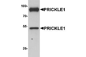 Western Blotting (WB) image for anti-Prickle-Like Protein 1 (PRICKLE1) (C-Term) antibody (ABIN1077370) (PRICKLE1 Antikörper  (C-Term))