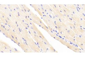 Detection of ACTN2 in Mouse Cardiac Muscle Tissue using Polyclonal Antibody to Actinin Alpha 2 (ACTN2) (ACTN2 Antikörper  (AA 1-254))