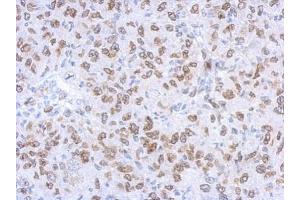 Immunohistochemistry (IHC) image for anti-Lamin A/C (LMNA) antibody (ABIN2854943)