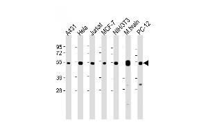 All lanes : Anti-TUBA4A Antibody (C-term) at 1:8000 dilution Lane 1: A431 whole cell lysate Lane 2: Hela whole cell lysate Lane 3: Jurkat whole cell lysate Lane 4: MCF-7 whole cell lysate Lane 5: NIH/3T3 whole cell lysate Lane 6: Mouse brain lysate Lane 7: PC-12 whole cell lysate Lysates/proteins at 20 μg per lane. (TUBA4A Antikörper  (C-Term))