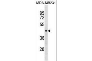 SPRYD5 Antibody (N-term) (ABIN1881827 and ABIN2838824) western blot analysis in MDA-M cell line lysates (35 μg/lane). (TRIM51 Antikörper  (N-Term))