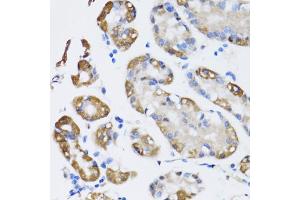 Immunohistochemistry of paraffin-embedded human stomach using NAA10 antibody. (NAA10 Antikörper)